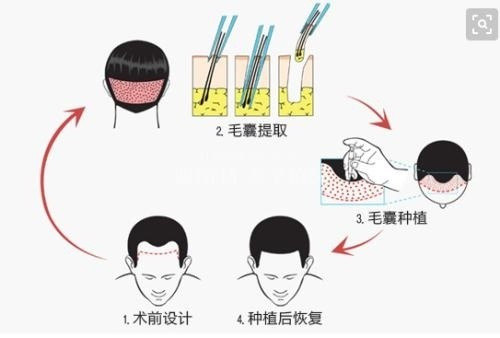 革新发型新选择，最新物理接发技术亮相！