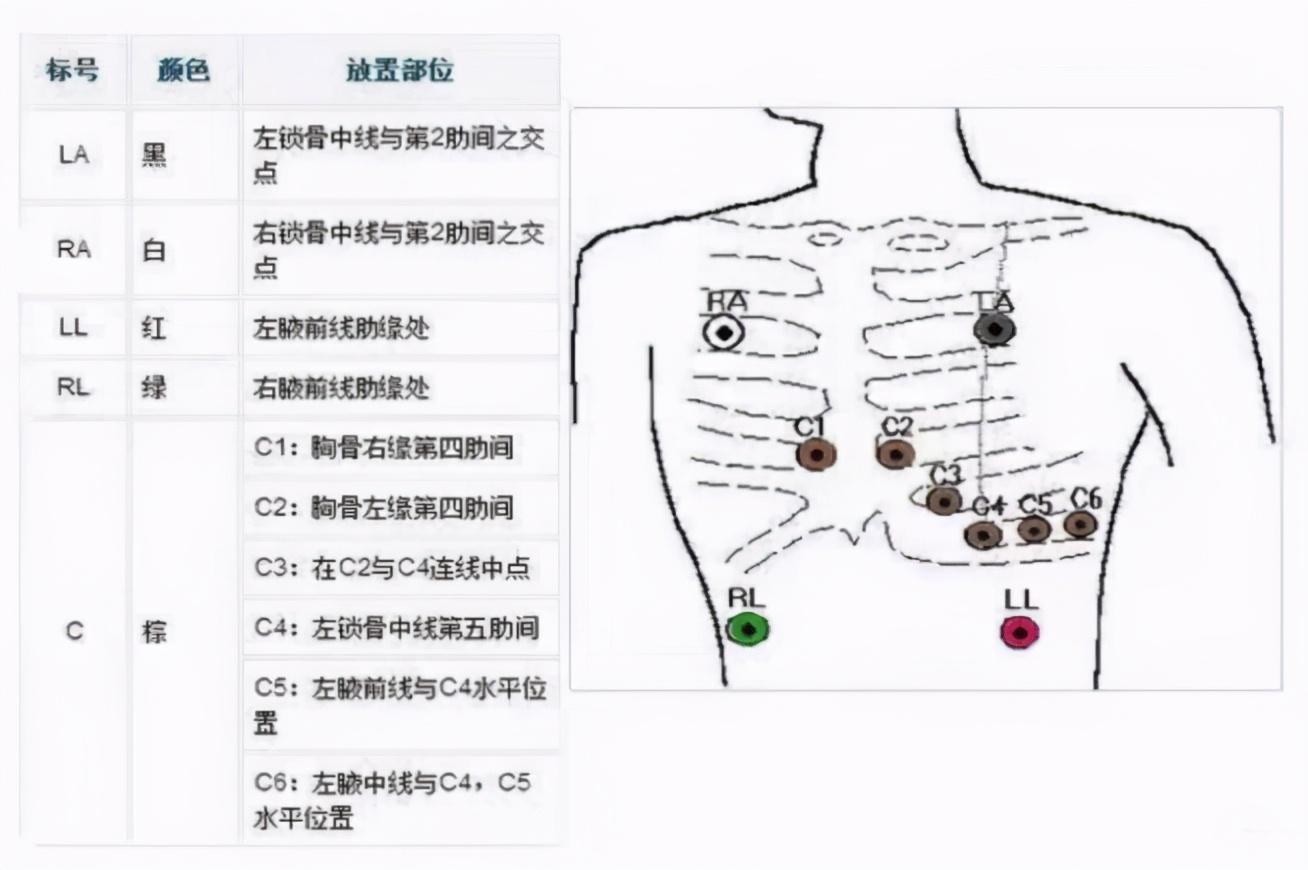 动态心电图最新仪器，科技引领心脏健康监测新篇章